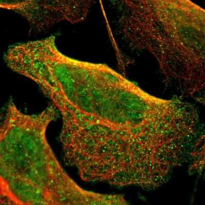 Immunocytochemistry/ Immunofluorescence: CD79B Antibody [NBP1-88945]