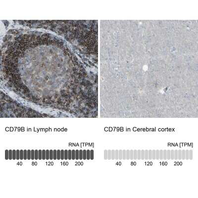 Immunohistochemistry-Paraffin: CD79B Antibody [NBP1-88945]