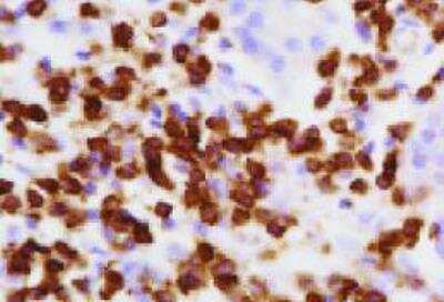 Immunohistochemistry-Paraffin: CD8 Antibody (12.C7) - BSA Free [NB100-64021]