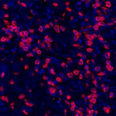 Immunocytochemistry/ Immunofluorescence: CD8 Antibody (BLR044F) [NBP2-76422]
