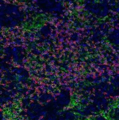 Immunocytochemistry/ Immunofluorescence: CD8 Antibody (BLR044F) [NBP2-76422]