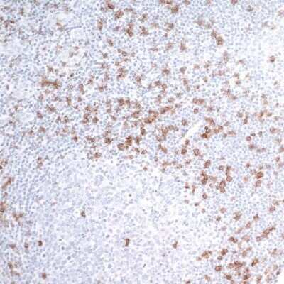 Immunohistochemistry-Paraffin: CD8 Antibody (BLR044F) [NBP2-76422]