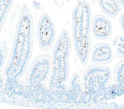 Immunohistochemistry: CD8 Antibody (BLR173J) [NBP3-14746]