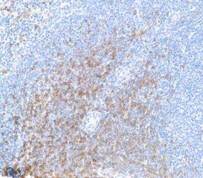 Immunohistochemistry: CD8 Antibody (BLR173J) [NBP3-14746]