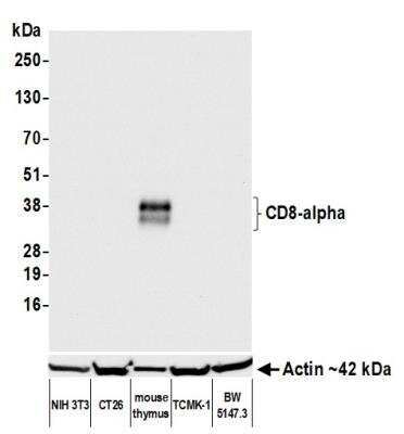 Western Blot: CD8 Antibody (BLR173J) [NBP3-14746]