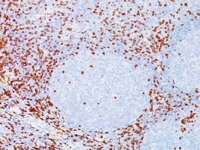 Immunohistochemistry-Paraffin: CD8 Antibody (C8/144B) - IHC-Prediluted [NBP2-45325]