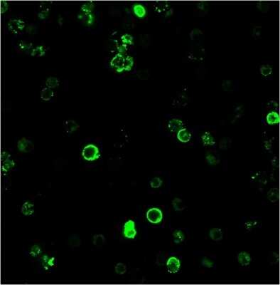 Immunocytochemistry/ Immunofluorescence: CD8 Antibody (C8/468) [NBP2-32952]