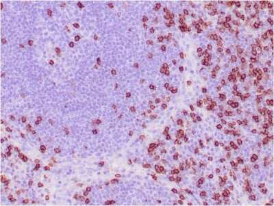 Immunohistochemistry-Paraffin: CD8 Antibody (C8/468) [NBP2-32952]