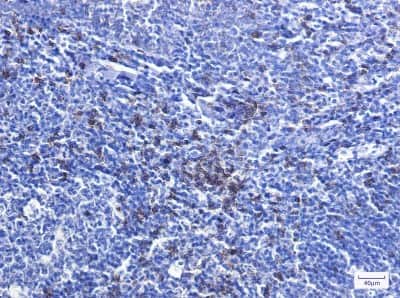 Immunohistochemistry-Paraffin: CD8 Antibody (S09-8E7) [NBP3-14871]