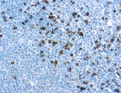 Immunohistochemistry-Paraffin: CD8 Antibody (SP16) [NBP2-26484]
