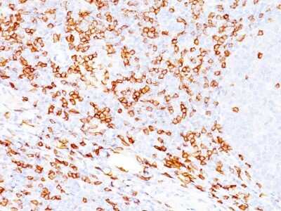 Immunohistochemistry-Paraffin: CD8 Antibody (SPM548) [NBP2-32835]