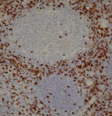 Immunohistochemistry-Paraffin: CD8 Antibody (4B11) [NB100-65729]