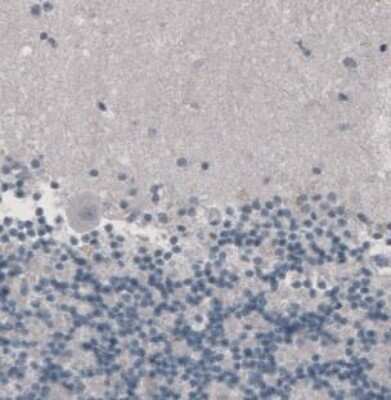 Immunohistochemistry-Paraffin: CD8 Antibody (CL1529) [NBP2-36743]
