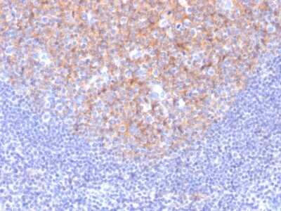 Immunohistochemistry-Paraffin: CD81 Antibody (1.3.3.22) [NBP2-53318]