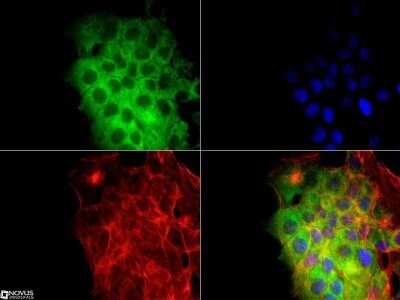 Immunocytochemistry/ Immunofluorescence: CD81 Antibody (1D6) - Azide and BSA Free [NBP2-80660]