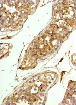 Immunohistochemistry: CD81 Antibody (1D6) - Azide and BSA Free [NBP2-80660]