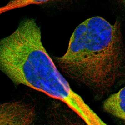 Immunocytochemistry/ Immunofluorescence: CD81 Antibody [NBP1-80701]