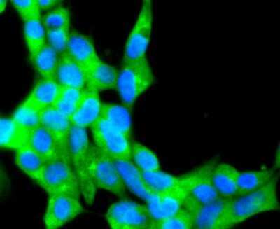 Immunocytochemistry/ Immunofluorescence: CD81 Antibody (SN206-01) [NBP2-67722]