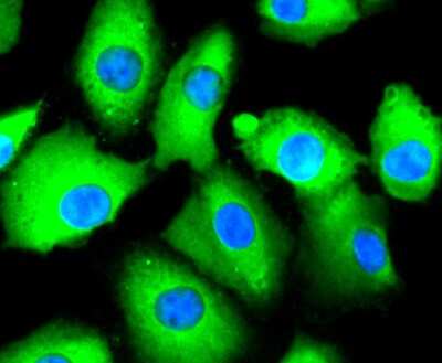 Immunocytochemistry/ Immunofluorescence: CD81 Antibody (SN206-01) [NBP2-67722]