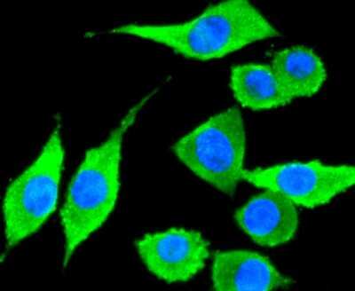 Immunocytochemistry/ Immunofluorescence: CD81 Antibody (SN206-01) [NBP2-67722]
