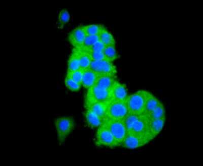 Immunocytochemistry/ Immunofluorescence: CD81 Antibody (SN206-01) [NBP2-67722]