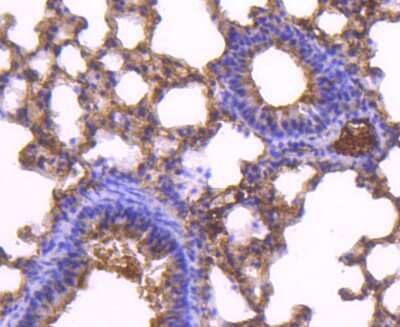 Immunohistochemistry-Paraffin: CD81 Antibody (SN206-01) [NBP2-67722]