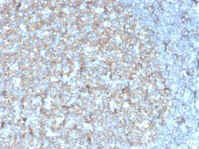 Immunohistochemistry-Paraffin: CD81 Antibody (rC81/3442) - Azide and BSA Free [NBP3-08795]