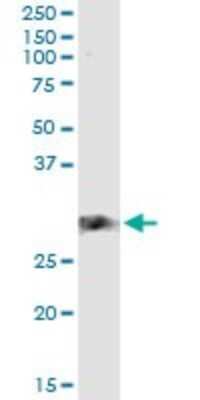 Immunoprecipitation: CD83 Antibody (3G10-1F4) [H00009308-M01]