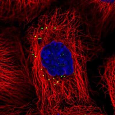 Immunocytochemistry/ Immunofluorescence: CD83 Antibody [NBP2-38485]