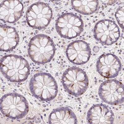 Immunohistochemistry-Paraffin: CD83 Antibody [NBP2-38485]