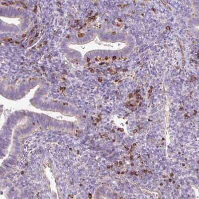 Immunohistochemistry-Paraffin: CD83 Antibody [NBP2-38485]