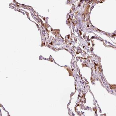 Immunohistochemistry-Paraffin: CD83 Antibody [NBP2-38485]