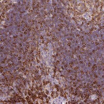 Immunohistochemistry-Paraffin: CD83 Antibody [NBP2-38485]