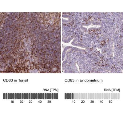 Immunohistochemistry-Paraffin: CD83 Antibody [NBP2-38485]