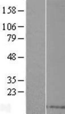 Western Blot: CD83 Overexpression Lysate [NBP2-08509]
