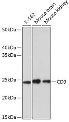 Western Blot: CD9 Antibody (10N2L6) [NBP3-15593]