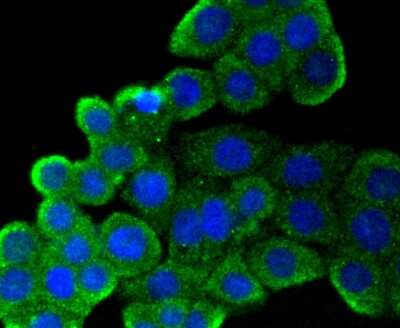 Immunocytochemistry/ Immunofluorescence: CD9 Antibody (SA35-08) [NBP2-67310]