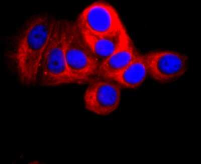 Immunocytochemistry/ Immunofluorescence: CD90/Thy1 Antibody (JF10-09) [NBP2-66763]