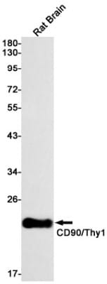 Western Blot: CD90/Thy1 Antibody (S09-6G7) [NBP3-20016]