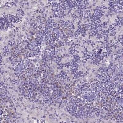 Immunohistochemistry-Paraffin: CD96 Antibody [NBP2-49491]