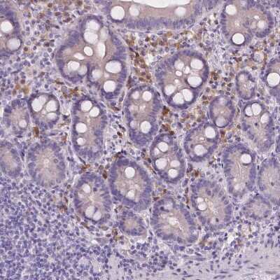 Immunohistochemistry-Paraffin: CD96 Antibody [NBP2-49491]