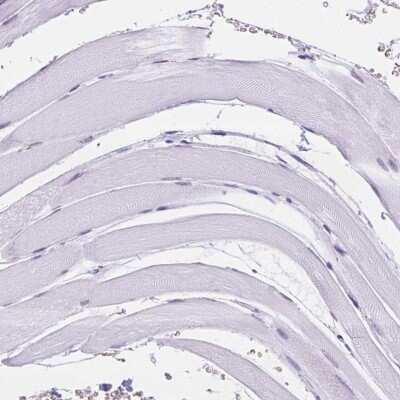 Immunohistochemistry-Paraffin: CD96 Antibody [NBP2-49491]