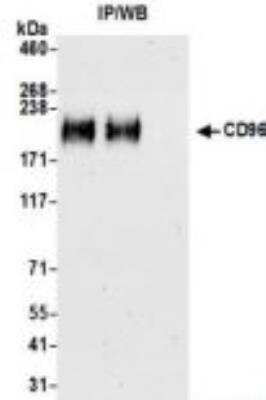 Immunoprecipitation: CD96 Antibody (BLR065G) [NBP3-14682]