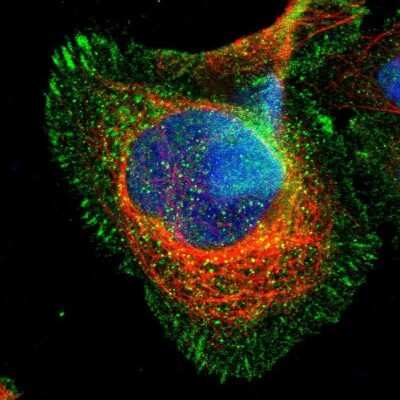 Immunocytochemistry/ Immunofluorescence: CD98 Antibody [NBP2-47515]