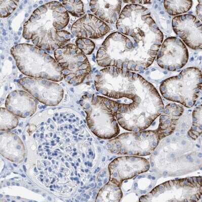 Immunohistochemistry-Paraffin: CD98 Antibody [NBP2-47515]