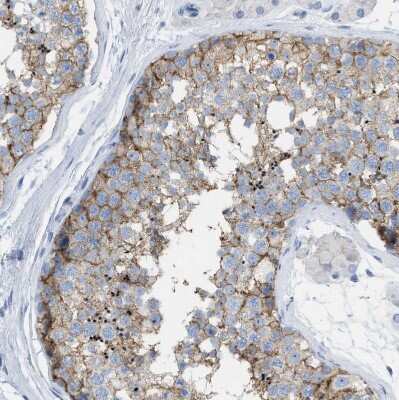 Immunohistochemistry-Paraffin: CD98 Antibody [NBP2-47515]