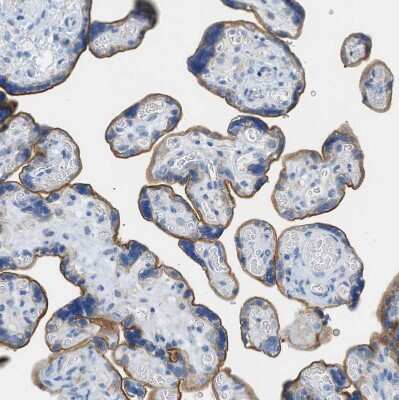 Immunohistochemistry-Paraffin: CD98 Antibody [NBP2-47515]