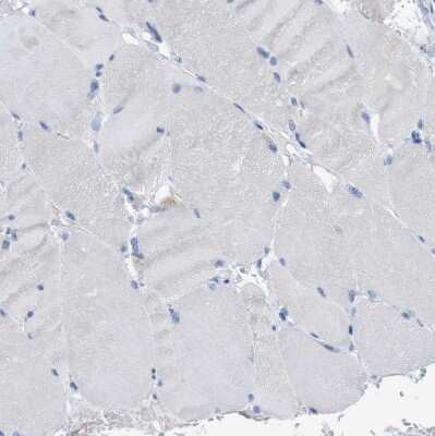 Immunohistochemistry-Paraffin: CD98 Antibody [NBP2-47515]