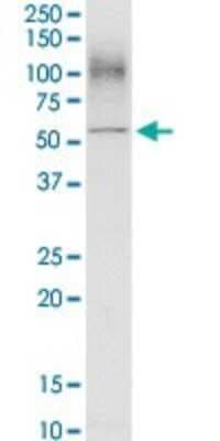 Western Blot: CD98 Antibody [H00006520-D01P]