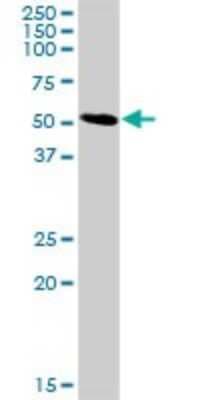 Western Blot: CD98 Antibody [H00006520-D01P]